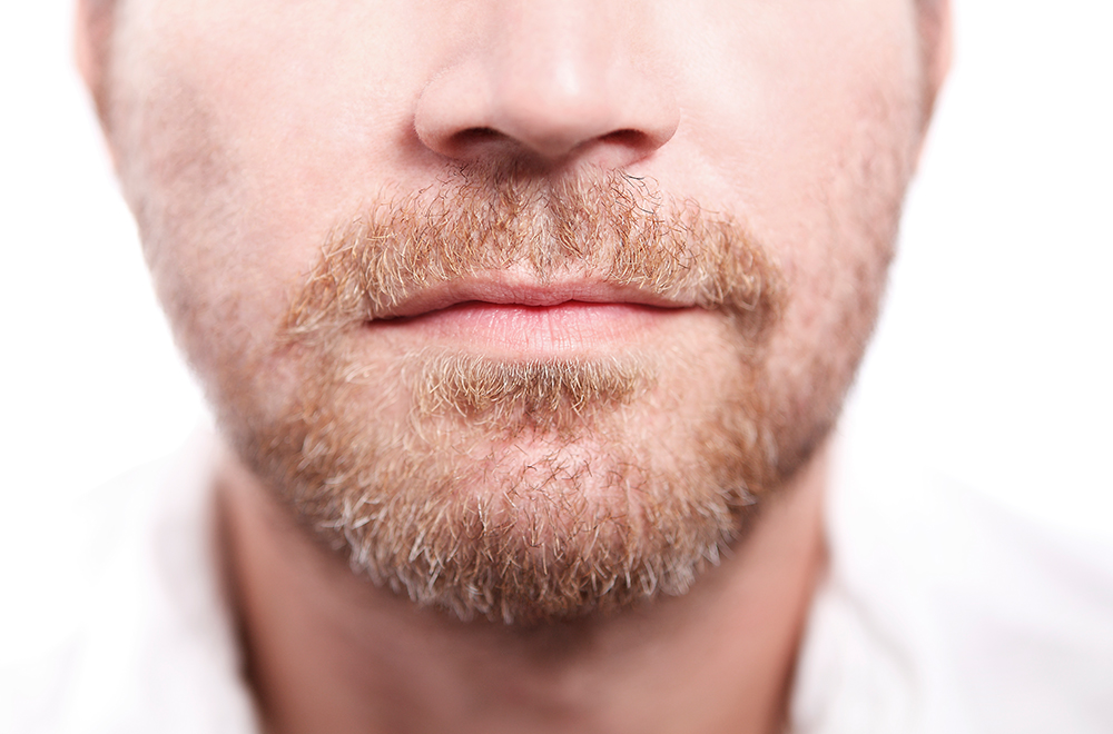 Patchy Beard